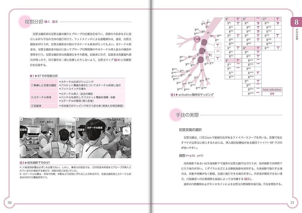 気管支サーモプラスティパーフェクトガイド [単行本] 石井 芳樹 気管支サーモプラスティパーフェクトガイド | 石井 芳樹, 石井